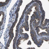 Anti-CDK17 antibody produced in rabbit Prestige Antibodies&#174; Powered by Atlas Antibodies, affinity isolated antibody, buffered aqueous glycerol solution