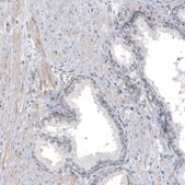 Anti-TMEM43 antibody produced in rabbit Prestige Antibodies® Powered by Atlas Antibodies, affinity isolated antibody, buffered aqueous glycerol solution