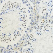 Anti-TriMethyl-Histone H3-K36 antibody produced in rabbit