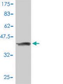 Monoclonal Anti-MASA antibody produced in mouse clone 3C1-1D5, purified immunoglobulin, buffered aqueous solution
