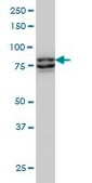 Monoclonal Anti-MTA1 antibody produced in mouse clone 4D11, purified immunoglobulin, buffered aqueous solution