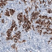 Monoclonal Anti-KRT7 antibody produced in mouse Prestige Antibodies® Powered by Atlas Antibodies, clone CL8723, purified immunoglobulin, buffered aqueous glycerol solution