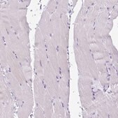 Anti-CST6 antibody produced in rabbit Prestige Antibodies&#174; Powered by Atlas Antibodies, affinity isolated antibody, buffered aqueous glycerol solution
