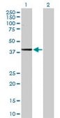 Anti-ADH1C antibody produced in rabbit purified immunoglobulin, buffered aqueous solution