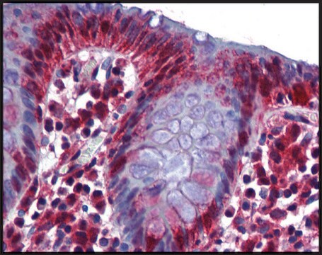 Anti-RBM47 antibody produced in rabbit affinity isolated antibody