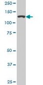 Monoclonal Anti-CAND1 antibody produced in mouse clone 1G5, purified immunoglobulin, buffered aqueous solution