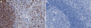 Anti-Lck Antibody, clone 2B20 ZooMAb&#174; Rabbit Monoclonal recombinant, expressed in HEK 293 cells