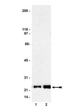 Ras Activation Assay Kit