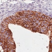 Monoclonal Anti-HER2 antibody produced in mouse Prestige Antibodies&#174; Powered by Atlas Antibodies, clone CL0269, purified immunoglobulin, buffered aqueous glycerol solution