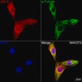 Anti-ACLY Antibody, clone 8A0V0, Rabbit Monoclonal
