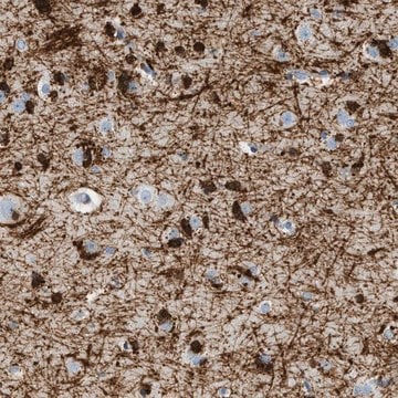Anti-DNAJC30 antibody produced in rabbit Prestige Antibodies&#174; Powered by Atlas Antibodies, affinity isolated antibody, buffered aqueous glycerol solution
