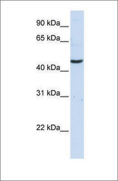 Anti-CCBL2 antibody produced in rabbit affinity isolated antibody