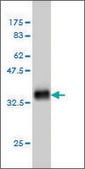 Monoclonal Anti-HOXD11 antibody produced in mouse clone 8B8, purified immunoglobulin, buffered aqueous solution