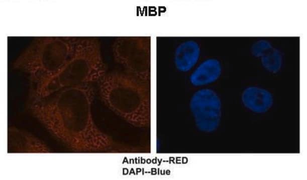 Anti-MBP antibody produced in rabbit affinity isolated antibody