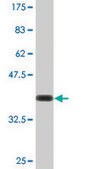 Monoclonal Anti-SYK antibody produced in mouse clone 4A7, ascites fluid