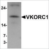 Anti-VKORC1 antibody produced in rabbit affinity isolated antibody