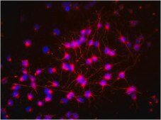 Anti-Nestin Antibody, clone rat-401, Biotin Conjugate clone rat-401, from mouse, biotin conjugate