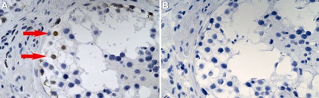 Anti-cIAP2/BIRC3 Antibody, clone 1N23 ZooMAb&#174; Rabbit Monoclonal recombinant, expressed in HEK 293 cells