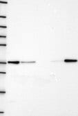 Anti-RPRD1B antibody produced in rabbit Prestige Antibodies&#174; Powered by Atlas Antibodies, affinity isolated antibody, buffered aqueous glycerol solution