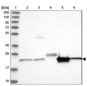 Anti-CDC123 antibody produced in rabbit Prestige Antibodies&#174; Powered by Atlas Antibodies, affinity isolated antibody, buffered aqueous glycerol solution