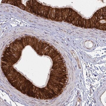 Anti-LYSMD4 antibody produced in rabbit Prestige Antibodies&#174; Powered by Atlas Antibodies, affinity isolated antibody, buffered aqueous glycerol solution