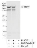 Rabbit anti-SMRT Antibody, Affinity Purified Powered by Bethyl Laboratories, Inc.