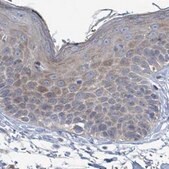 Anti-RPL32 antibody produced in rabbit Prestige Antibodies&#174; Powered by Atlas Antibodies, affinity isolated antibody, buffered aqueous glycerol solution