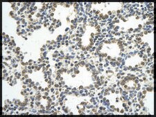 Anti-CSTF2 antibody produced in rabbit affinity isolated antibody