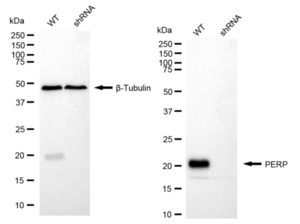 KD-Validated Anti PERP Antibody, clone 24GB1630, Rabbit Monoclonal clone 24GB1630, recombinant rabbit monoclonal, expressed in HEK293 cells