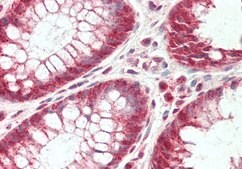 Anti-CLPTM1L antibody produced in rabbit affinity isolated antibody