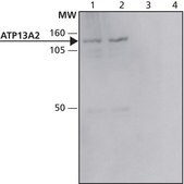 Anti-ATP13A2 antibody produced in rabbit ~1&#160;mg/mL, affinity isolated antibody, buffered aqueous solution