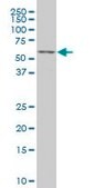 Monoclonal Anti-TCF7L2, (C-terminal) antibody produced in mouse clone 3A4, purified immunoglobulin, buffered aqueous solution
