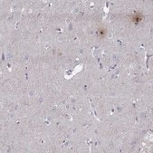 Anti-PCSK1N antibody produced in rabbit Prestige Antibodies&#174; Powered by Atlas Antibodies, affinity isolated antibody, buffered aqueous glycerol solution
