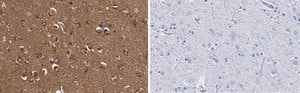 Anti-DKK3 Antibody, clone 3H17 ZooMAb&#174; Rabbit Monoclonal recombinant, expressed in HEK 293 cells