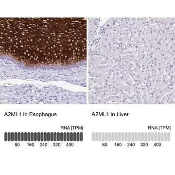Anti-A2ML1 antibody produced in rabbit Prestige Antibodies&#174; Powered by Atlas Antibodies, affinity isolated antibody, buffered aqueous glycerol solution