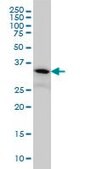 Monoclonal Anti-FLJ20643 antibody produced in mouse clone 1E8, purified immunoglobulin, buffered aqueous solution