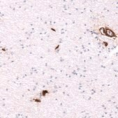 Monoclonal Anti-ITGB1 antibody produced in mouse Prestige Antibodies® Powered by Atlas Antibodies, clone CL15622, purified antibody (Protein A)