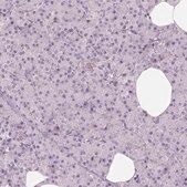 Anti-CDS1 Prestige Antibodies&#174; Powered by Atlas Antibodies, affinity isolated antibody