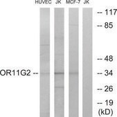 Anti-OR11G2 antibody produced in rabbit affinity isolated antibody