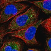 Anti-ZNF720 antibody produced in rabbit Prestige Antibodies® Powered by Atlas Antibodies, affinity isolated antibody, buffered aqueous glycerol solution