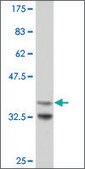 Monoclonal Anti-ARX antibody produced in mouse clone 2A7, purified immunoglobulin, buffered aqueous solution