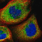 Anti-WDR34 antibody produced in rabbit Prestige Antibodies&#174; Powered by Atlas Antibodies, affinity isolated antibody, buffered aqueous glycerol solution