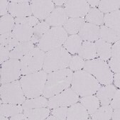 Anti-SCML2 antibody produced in rabbit Prestige Antibodies&#174; Powered by Atlas Antibodies, affinity isolated antibody