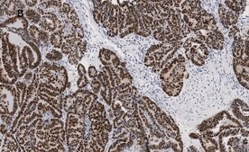 抗-p53抗体，克隆6O23，ZooMAb&#174;兔单克隆 recombinant, expressed in HEK 293 cells