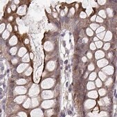 Anti-PLEKHG3 antibody produced in rabbit Prestige Antibodies&#174; Powered by Atlas Antibodies, affinity isolated antibody