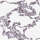 Anti-SNAI1 antibody produced in rabbit Prestige Antibodies&#174; Powered by Atlas Antibodies, affinity isolated antibody