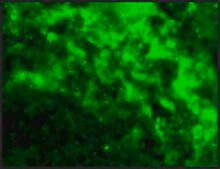 Anti-DC-SIGN (ab1) antibody produced in rabbit affinity isolated antibody, buffered aqueous solution