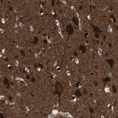 Anti-DCLK1 antibody produced in rabbit Prestige Antibodies&#174; Powered by Atlas Antibodies, affinity isolated antibody, buffered aqueous glycerol solution