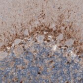 Monoclonal Anti-GLUL antibody produced in mouse Prestige Antibodies® Powered by Atlas Antibodies, clone CL3004, purified immunoglobulin, buffered aqueous glycerol solution