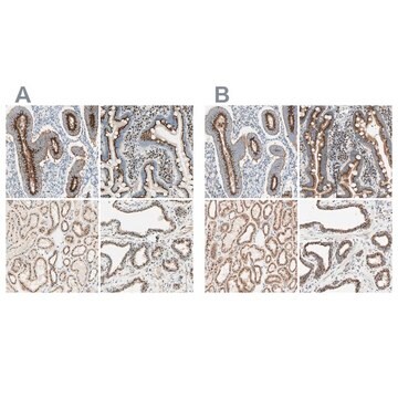 Anti-GOLGB1 antibody produced in rabbit Ab2, Prestige Antibodies® Powered by Atlas Antibodies, affinity isolated antibody, buffered aqueous glycerol solution
